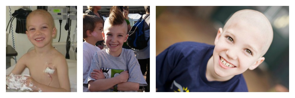 Photos of Preston Kilzer during and after treatment for childhood cancer